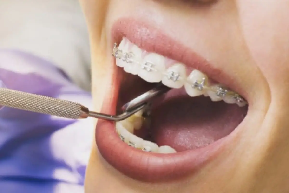 https://www.odontoartlaser.com/wp-content/uploads/2021/09/servicios3.webp