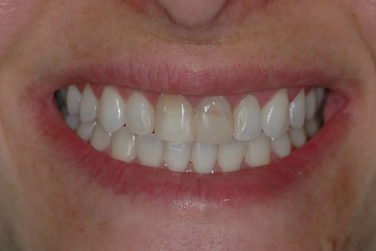 https://www.odontoartlaser.com/wp-content/uploads/2021/09/servicios4.jpg