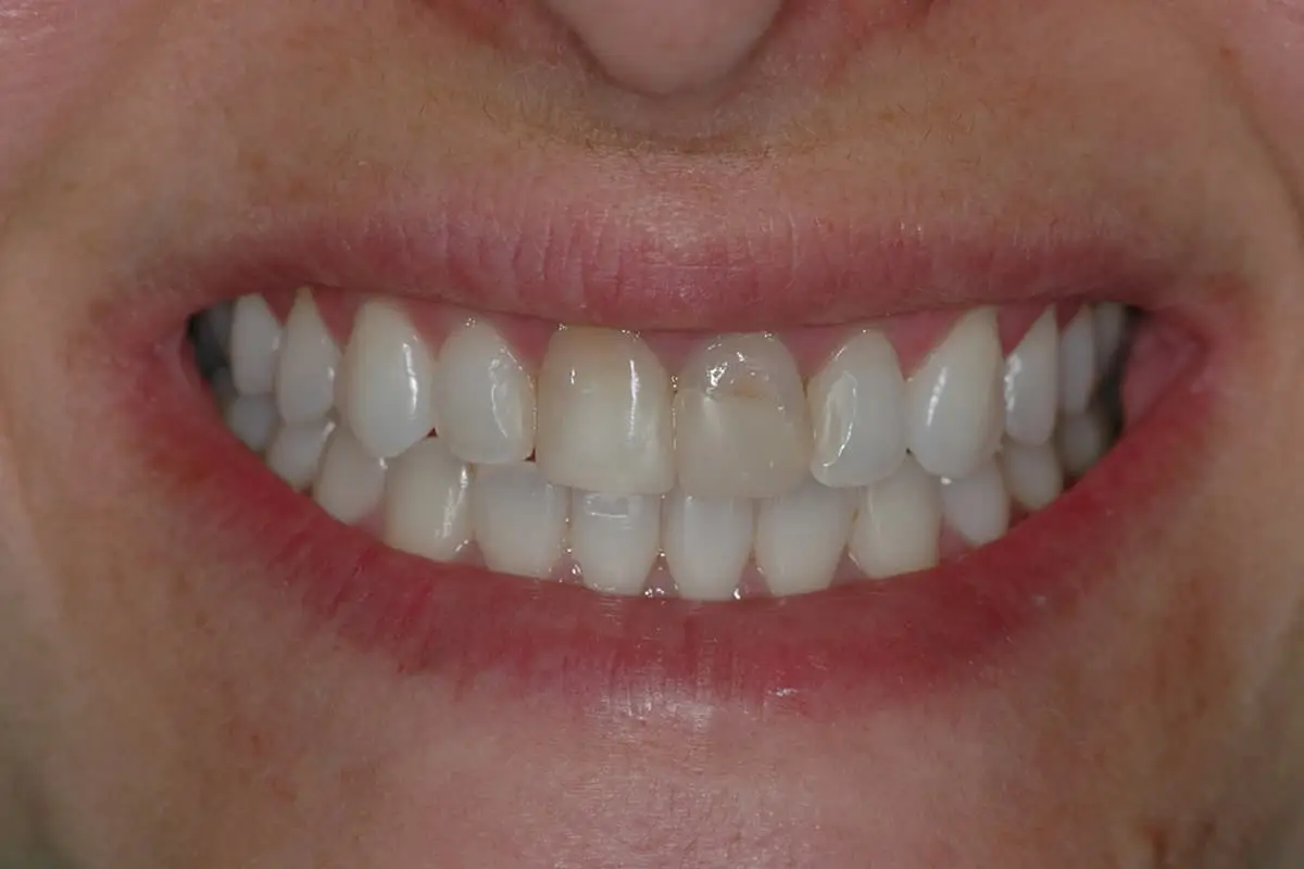 https://www.odontoartlaser.com/wp-content/uploads/2021/09/servicios4.webp